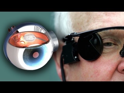 Bionic Eye Cures Blindness - UCzWQYUVCpZqtN93H8RR44Qw