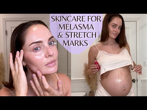 My Evening Skincare Routine for Melasma & Stretch Marks (During Pregnancy)