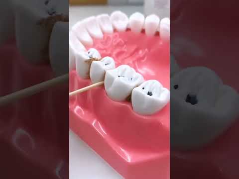 ✅ How to use floss. -  Oral Breeze Dental Floss Tooth Cleaning Kit ( # 2135 )