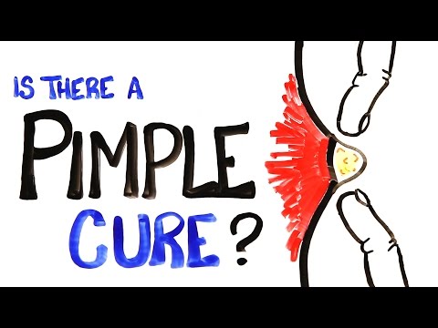 Is There A Pimple Cure? - UCC552Sd-3nyi_tk2BudLUzA