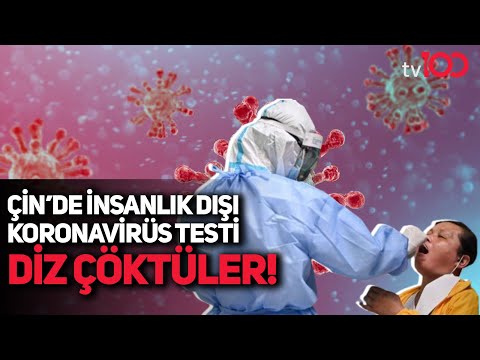 Çin’de vatandaşları diz çökerek koronavirüs testi oldu!