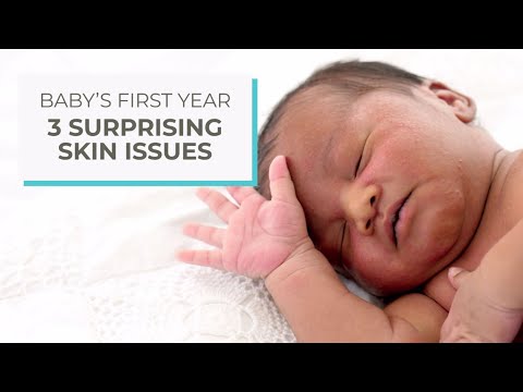 3 surprising skin issues | Ad Content by Huggies