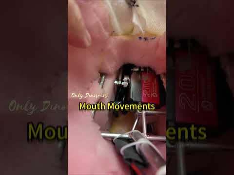 What's underneath the skin and how does it work