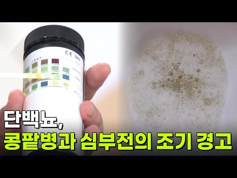 [의학 팩트체크] <strong>단백뇨</strong>, 콩팥병과 심부전의 조기 경고! [무엇이든 물어보세요] | KBS 260928 방송