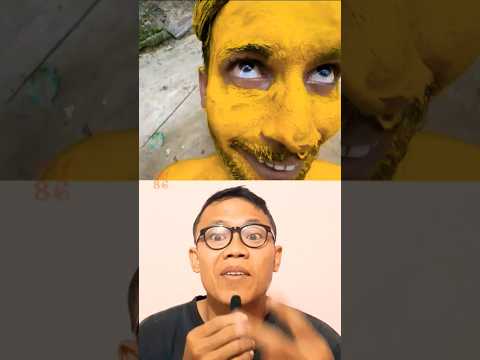 SEMBURAN CAIRAN KUNING MENGENAI MUKA part2 #alurcerita #storytelling #comedy #vrindavan #viral #lucu