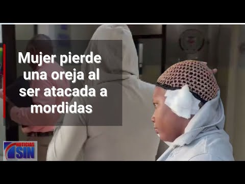 #NoticiasSIN: Mujer pierde oreja