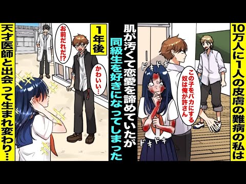 【漫画】生まれた時から10万人に１人の皮膚の難病だった私は肌をバカにされて恋愛を諦めていたがイケメン同級生に優しくされて好きになってしまった…１年後、天才医師と出会って肌が綺麗になった私は・・・
