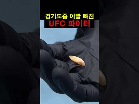 경기도중 이빨 빠진 <strong>UFC</strong> 파이터