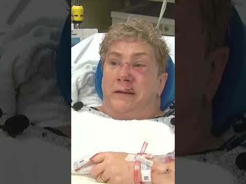 'I was gonna die' says woman after black bear attack in Pennsylvania