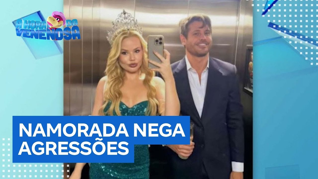 Namorada de Dado Dolabella nega agressões do ator e explica hematomas Sou muito branca  TV Online Namorada de Dado Dolabella nega agressões do ator e explica hematomas Sou muito branca