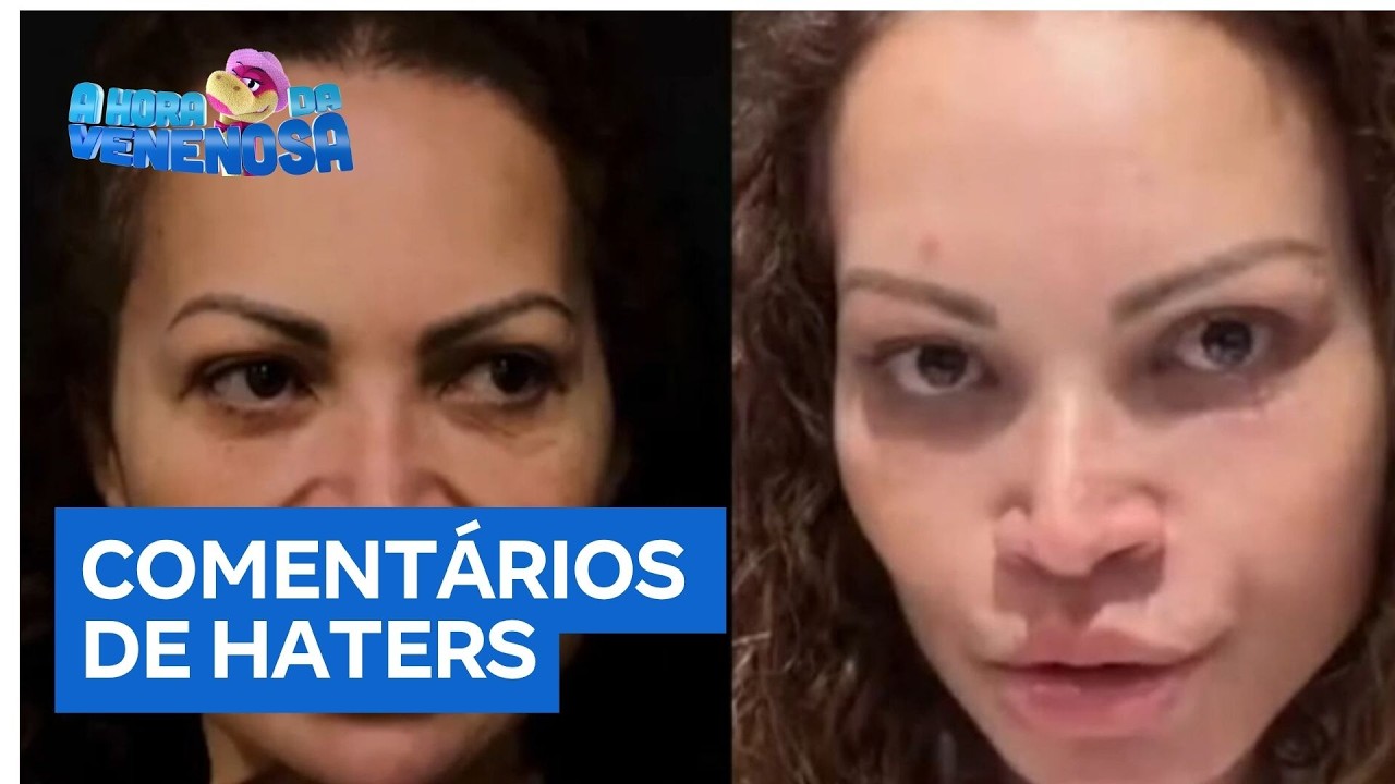 Solange Almeida rebate comentários maldosos na internet após cirurgia no rosto