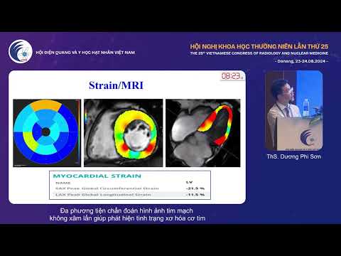 3. Đa phương tiện CĐHA tim mạch không xâm lấn phát hiện xơ hóa cơ tim (ThS. Dương Phi Sơn)