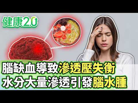 腦缺血導致滲透壓失衡 水分大量滲透引發腦水腫【健康2.0分段】@tvbshealth20  EP3198-1 20260523 #鄭凱云#康志森#鄔定宇#吳明珠#楊忠一