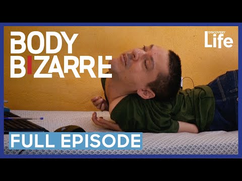 Body Bizarre: The Incredible Upside Down Man | Full Episode