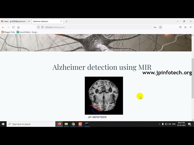Alzheimer’s Disease Prediction Using Machine Learning