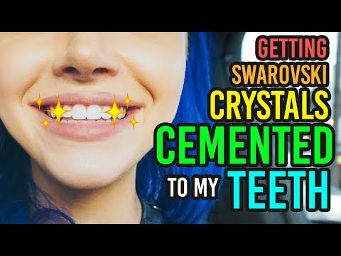 I GOT SWAROVSKI CRYSTALS CEMENTED TO MY TEETH - UCoziFm3M4sHDq1kkx0UwtRw