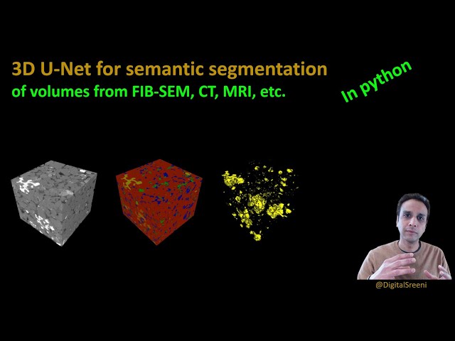 3D U-Net Segmentation with TensorFlow