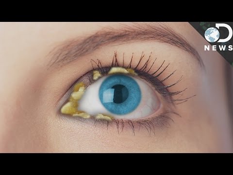 Why Do We Get Eye Boogers? - UCzWQYUVCpZqtN93H8RR44Qw