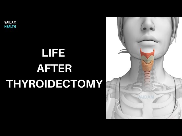 how-long-until-i-can-workout-after-a-thyroidectomy-workout-daily