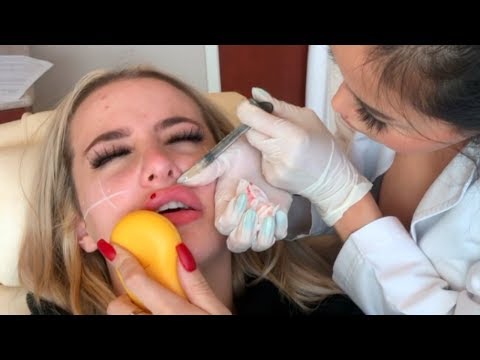 GET A FACE FULL OF FILLER WITH ME (graphic) (also fake) - UClWD8su9Sk6GzZDwy9zs3_w