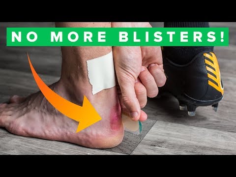 How to never get blisters again | Top 5 blister hacks - UC5SQGzkWyQSW_fe-URgq7xw