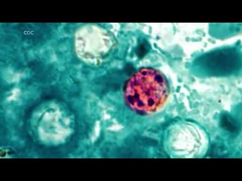 CU scientific review finds climate change makes it harder to control diseases like cyclosporiasis