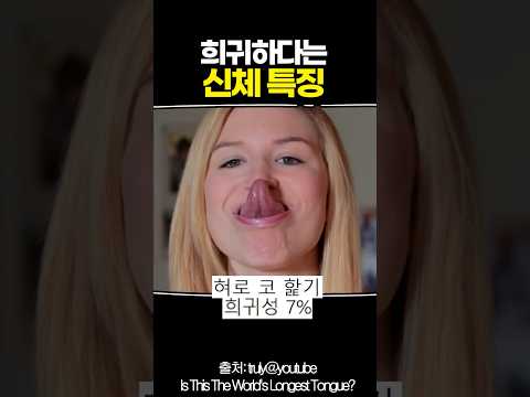 희귀하다는 신체 특징