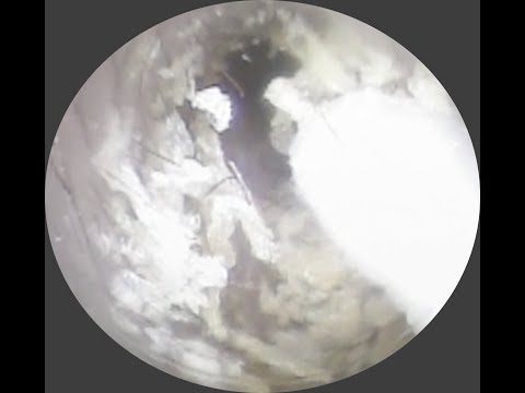 Vol.319【耳掃除】ドリルねじさん 床屋さんで耳掃除されちゃった~eariss