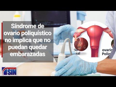 Mujeres con ovarios poliquísticos y mioma pueden embarazarse