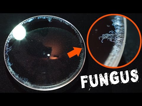 How to Remove Fungus from a Camera Lens FAST & EASY - UCYX22a35sKhA0T6ee7uZfvg