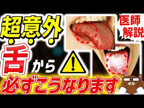 色・舌苔・歯の痕..絶対に見逃してはいけない「舌」からのSOS。舌は内臓を表す鏡「舌診」とは。舌の裏側も要注意。知らない公開する超意外なサインとは？がんの初期症状とは。医師が徹底解説！
