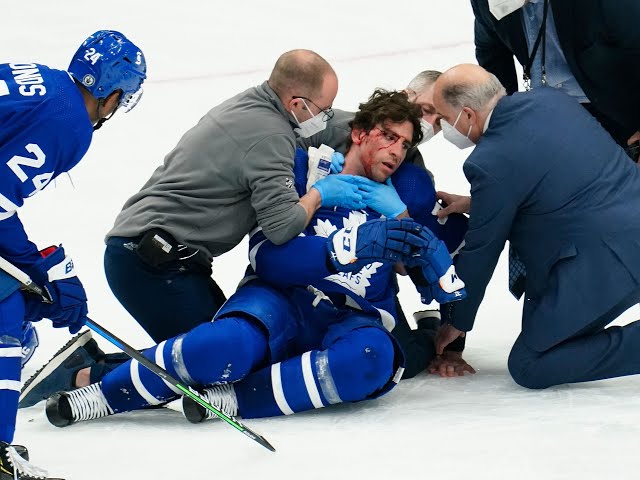 The Worst Hockey Injuries and How to Prevent Them