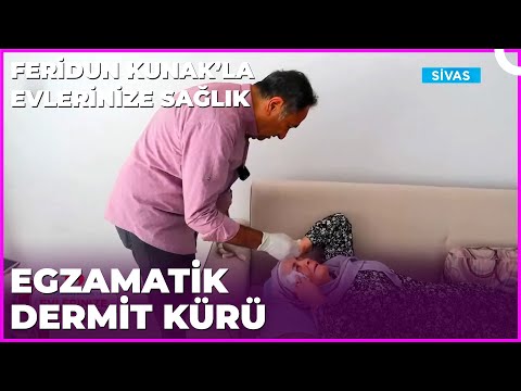 Egzamatik Dermit Yaralarına İyi Gelecek Müthiş İlaç | Dr. Feridun Kunak’la Evlerinize Sağlık