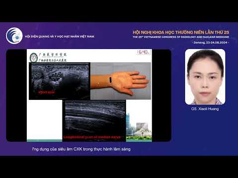 1. Ứng dụng của siêu âm cơ xương khớp trong thực hành lâm sàng (GS. Xiaoli Huang)