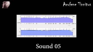 Sound 5 - fast tinnitus relief - sollievo acufene rapido