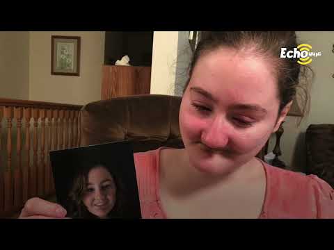 فتاة لا تشعر بالألم أو الوجع...من القصص الغريبة التي سنراها في حياتنا ..