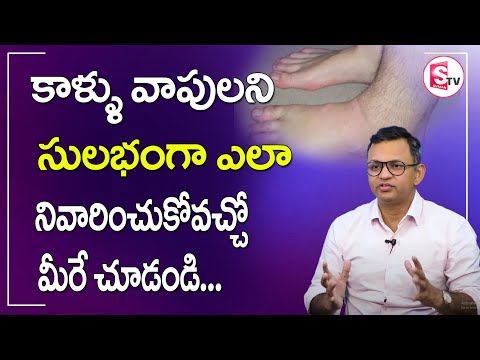 Treatment For Leg Swelling Problem | How To Treat Swollen Legs? | SumanTV HealthCare