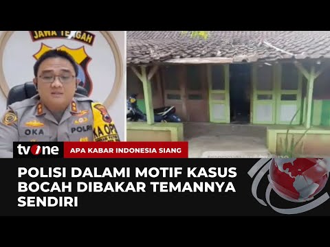 Bocah Diduga Dibakar Teman Sendiri, Korban Mengalami Luka Bakar 32% - TvOne