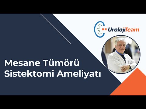 Mesane Tümörü #Sistektomi Ameliyatı