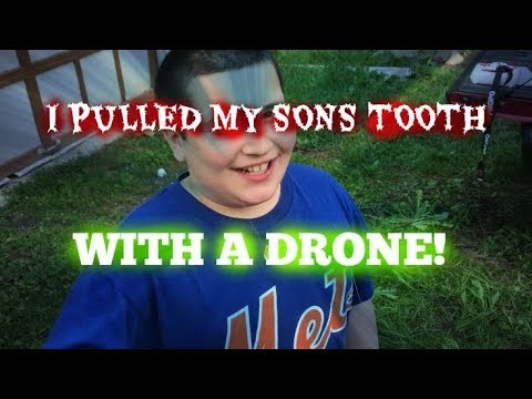 Syma X8C - Pulling A Tooth With A Quadcopter! - UCU33TAvzA-wgPMgcrdMVIdg