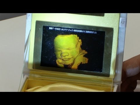 3D/4D ultrasound hologram printing service using Pioneer's compact holographic printer #DigInfo - UCOHoBDJhP2cpYAI8YKroFbA