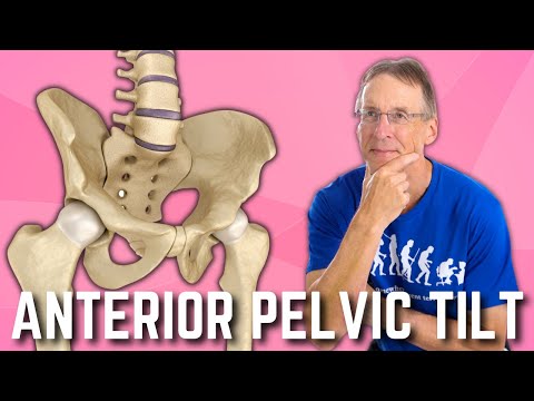 Anterior Pelvic Tilt? Do You Have It?  How to Fix? A  BIG SURPRISE! - UCmTe0LsfEbpkDpgrxKAWbRA