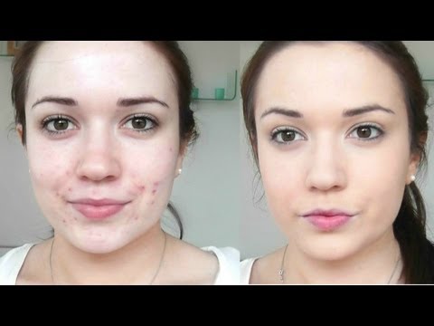 Foundation Routine - Covering Blemishes! - UC-1-zPmT368J8JRbsK_1keA