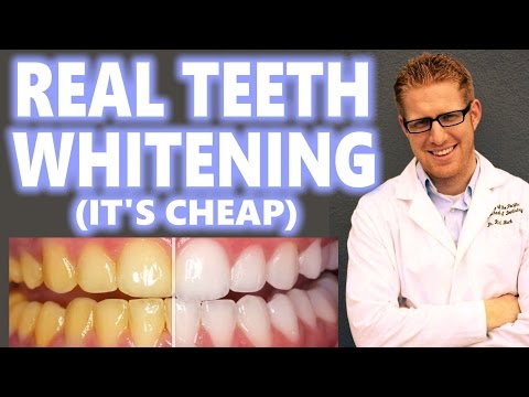 Teeth Whitening at Home Cheap How to Peroxide Hacks DIY Bleach Trays Kit Best 2016 Overnight Results - UCYG61PkPWdzQ_2R99U5Ogmg