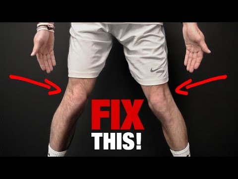 How to Fix Knee Valgus (KNEES THAT CAVE IN!) - UCe0TLA0EsQbE-MjuHXevj2A