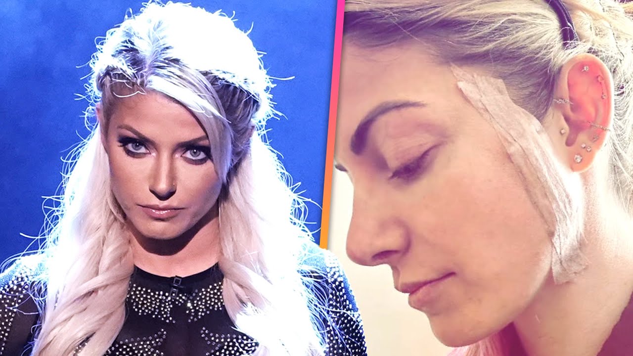 Alexa Bliss Reveals Skin Cancer Diagnosis Amid WWE Absence