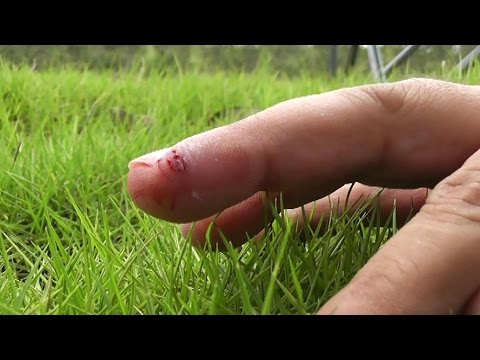 Mini Quadcopter Injury Nasty Deep Propeller cuts on Finger - UCsFctXdFnbeoKpLefdEloEQ