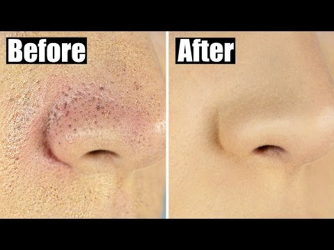 How to Reduce Bumpy, Textured Foundation for Smooth, Flawless Skin - UCZQ0XPE7wxMafUf8dIHOxgQ