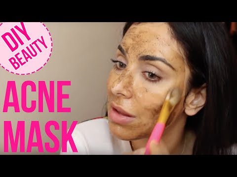 My Favorite Acne Miracle Mask! \ خلطة طبيعيّة لمعالجة حبّ الشباب - UCRSvEADlY-caz3sfDNwvR1A