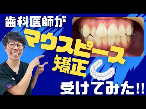 【僕の歯並び治るのか！？】噂のインビザライン矯正スタート動画！